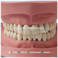 Standard K Type Removable Teeth Dental Anatomical Model 13004